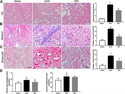 Eplerenone Attenuates Fibrosis in the Contralateral Kidney of UUO Rats by Preventing Macrophage-to-Myofibroblast Transition